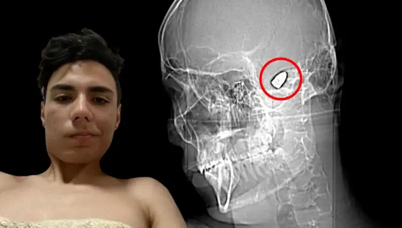 Duygu Depresyonu: Kafasında Patlayan Bomba İle Yaşamak